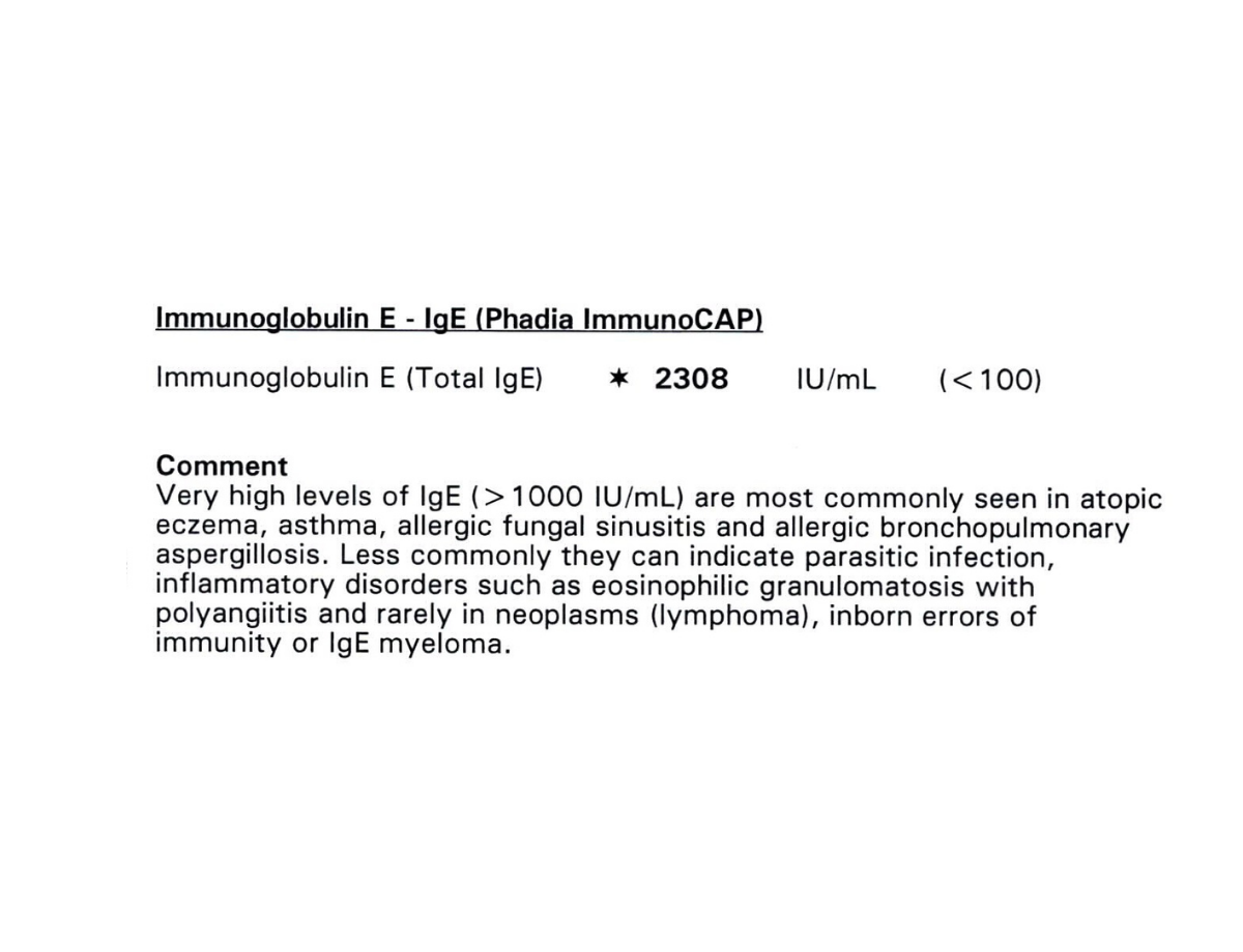 2022 Total IgE