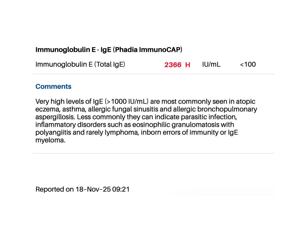 2025 Total IgE